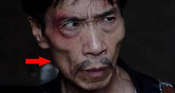 Việc thiếu thịt ở hai má cũng là một khuôn mặt xấu trong sinh lý học. Việc không có thịt ở hai má cho thấy người đó có điều kiện sống kém và không đủ dinh dưỡng, vì vậy những người ở trạng thái này có thể thích tham lam và rẻ tiền. Nếu bạn phải đối mặt với lợi ích, anh ta có thể không tử tế, vì sở thích phản bội bạn bè, đó là lý do tại sao nói không phù hợp để làm bạn.