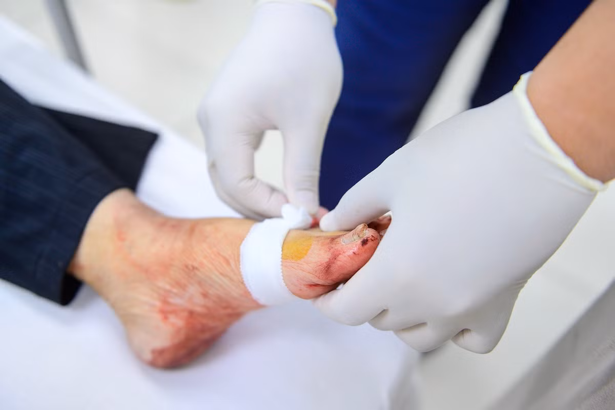 Ở một góc khác của khoa, một phụ nữ 61 tuổi nằm trên băng ca với bàn chân quấn chặt băng ép. Tai nạn xảy ra khi bà đi ăn sáng, bị một vật nhọn xuyên qua dép tổ ong, trúng mạch máu khiến máu chảy nhiều. Bà được chuyển đến sau khi sơ cứu tại trạm y tế phường. Các nhân viên y tế nhanh chóng may vết thương cầm máu và bác sĩ chỉ định đi chụp X-quang kiểm tra vết thương.