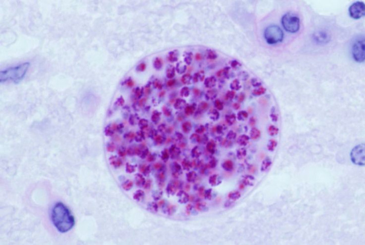 7. Con người cũng có thể bị ảnh hưởng hành vi do ký sinh trùng. Ví dụ, Toxoplasma gondii từng được nghi ngờ liên quan đến thay đổi tính cách, tăng rủi ro mắc bệnh tâm thần và rối loạn hành vi ở người. Ảnh: Pinterest.