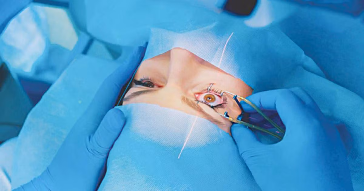 phau-thuat-lasik-vai-su-that-it-duoc-nhac-den1547524106.jpg