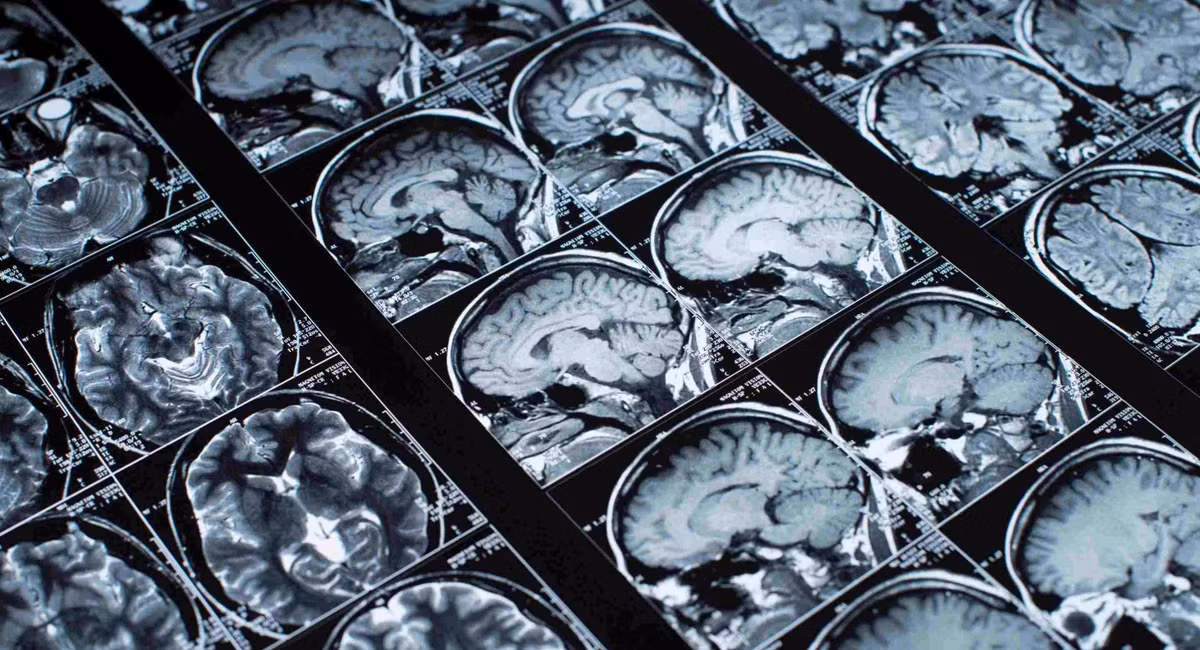 brain-imaging-scans.jpg