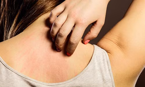 Video: Ngứa hoài không dứt, cảnh giác 7 bệnh “chết người"