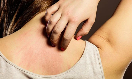 Video: Ngứa hoài không dứt, cảnh giác 7 bệnh “chết người"