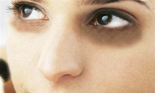 Video: Mắt thâm xì cũng hết vĩnh viễn chỉ với công thức đơn giản này