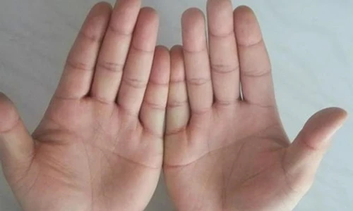 Video: Có dấu hiệu này trên bàn tay, đang nghèo bỗng giàu lên chóng mặt