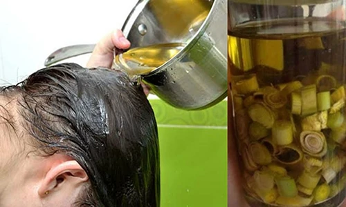 Video: Chữa tóc rụng kinh niên sau 1 lần gội