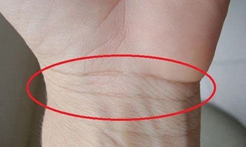 Video: Nhìn ngấn cổ tay biết ngay sức khỏe số phận giàu nghèo của bạn