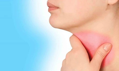 Video: Không muốn mắc ung thư vòm họng bỏ 4 thói quen này