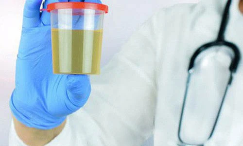 Video: 10 bí mật về nước tiểu liên quan đến thận, sức khỏe