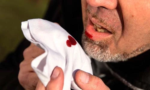 Video: 6 “dấu hiệu” cảnh báo bệnh phổi đang tiến triển âm thầm