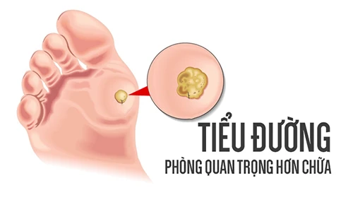 Video: Mắc bệnh tiểu đường từ những nguyên nhân ít ai ngờ