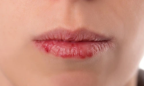 Video: 4 dấu hiệu chứng tỏ cơ thể bạn cần thải độc ngay lập tức