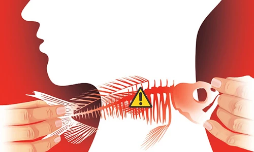 Video: Mẹo chữa hóc xương cá khỏi ngay lập tức