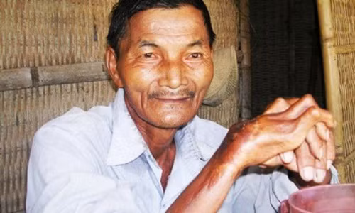 Video: 10 người thường có siêu năng lực sau tai nạn thập tử nhất sinh