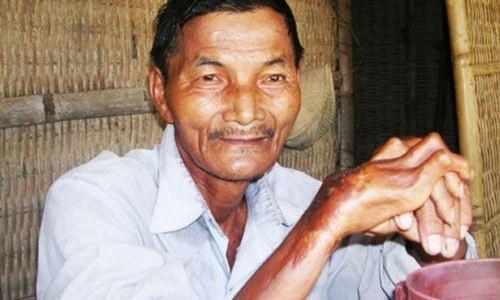 Video: 10 người thường có siêu năng lực sau tai nạn thập tử nhất sinh