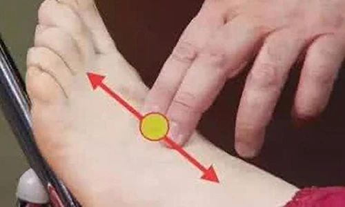 Video: 5 giải pháp giúp bạn tự cứu mình khỏi bệnh tắc mạch máu