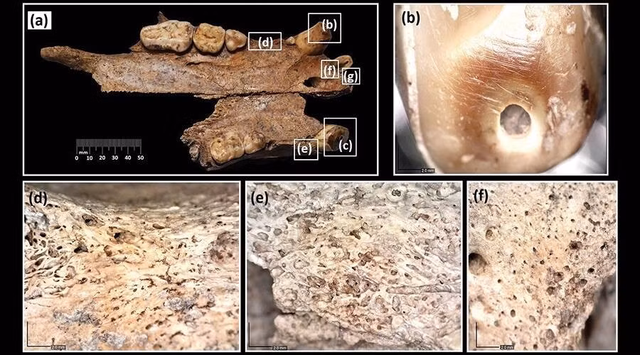 Theo nghiên cứu của các chuyên gia, hộp sọ thuộc về một con gấu nâu đực 6 tuổi (tên khoa học là Ursus arctos). Hộp sọ được phát hiện trong cuộc khai quật năm 2016 gần đấu trường và kể từ đó đã được các nhà khoa học nghiên cứu kỹ lưỡng. Ảnh: Nemanja Marković et al; Antiquity Publications Ltd.