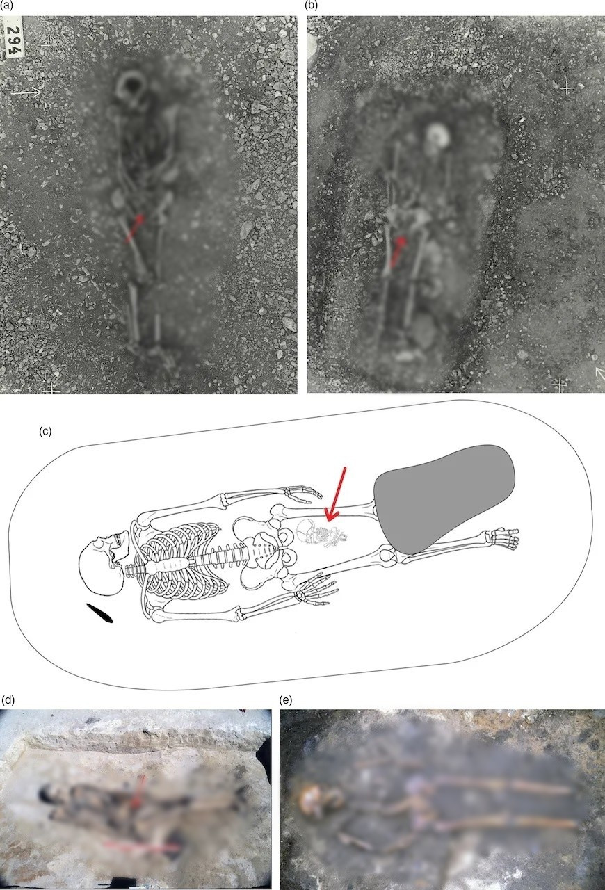 Nhà khảo cổ học Neil Price nhận định ngôi mộ có chứa nhiều đồ tùy táng giá trị cho thấy người phụ nữ được chôn cất tại đó có thể đã giữ vai trò quan trọng trong xã hội Viking khi ấy với tư cách là người thực hành phép thuật hoặc nghi lễ. Ảnh: Kopparsvik / Toplak / Matt Hitchcock.