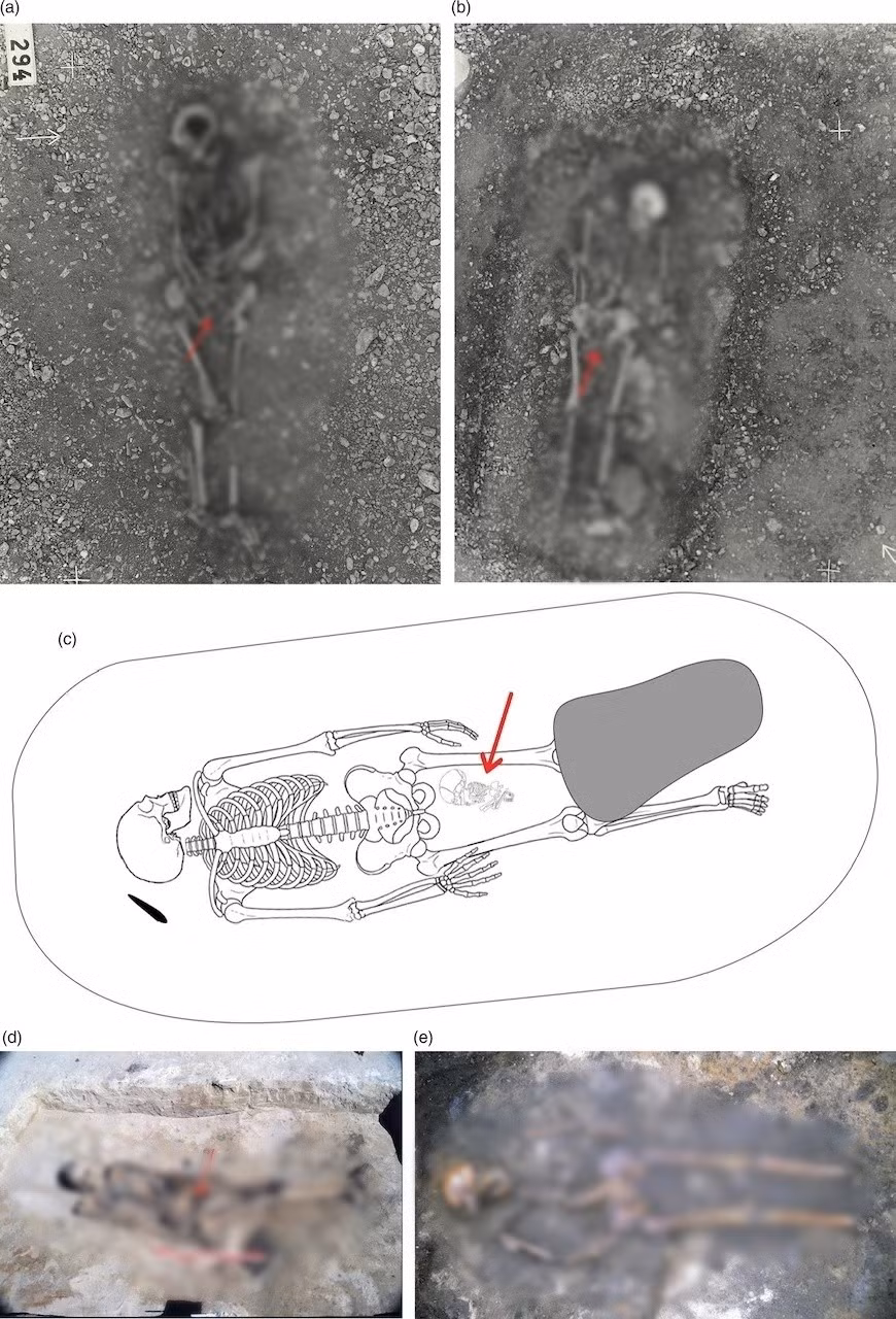 Nhà khảo cổ học Neil Price nhận định ngôi mộ có chứa nhiều đồ tùy táng giá trị cho thấy người phụ nữ được chôn cất tại đó có thể đã giữ vai trò quan trọng trong xã hội Viking khi ấy với tư cách là người thực hành phép thuật hoặc nghi lễ. Ảnh: Kopparsvik / Toplak / Matt Hitchcock.