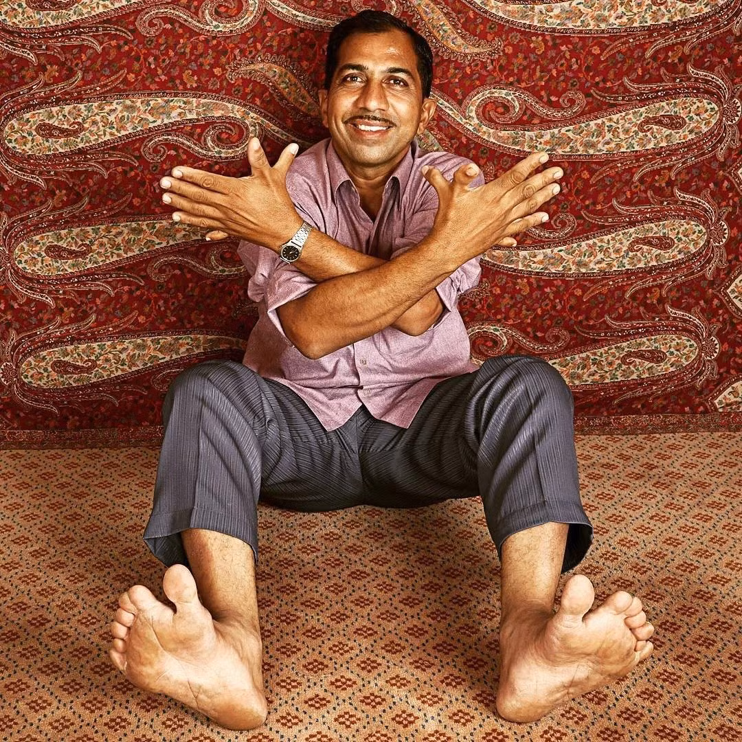 Devendra Suthar nắm giữ một kỷ lục Guinness kỳ quặc đó là có nhiều ngón tay hơn bất kỳ ai khác trên thế giới. Do mắc phải một tình trạng đặc biệt nên ông Suthar có 7 ngón tay trên mỗi bàn tay và 7 ngón chân trên mỗi bàn chân. Ảnh: Instagram/Guinnesswordrecords.