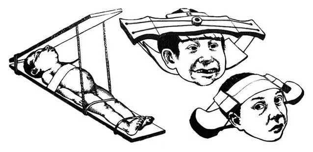 Nhóm nghiên cứu không tìm thấy thấy bất kỳ chấn thương nào trên bộ xương của đứa trẻ nhưng ghi nhận "sự thay đổi rõ ràng ở hộp sọ". Ảnh: Psychology Today.