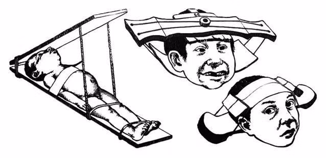 Nhóm nghiên cứu không tìm thấy thấy bất kỳ chấn thương nào trên bộ xương của đứa trẻ nhưng ghi nhận "sự thay đổi rõ ràng ở hộp sọ". Ảnh: Psychology Today.