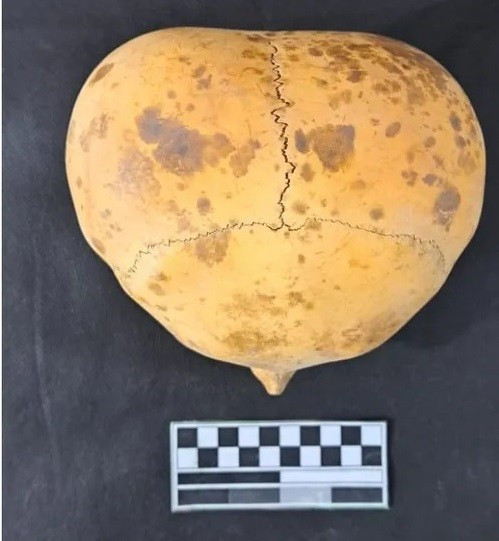 Cristian Sebastián Melián, Giám đốc Sở Nhân chủng học tỉnh Catamarca, Argentina, cho hay tình trạng hộp sọ cho thấy đây là kết quả của tập tục kéo dài hộp sọ của nền văn hóa cổ xưa. Ảnh: Provincial Directorate of Anthropology / Catamarca Ministry of Culture, Tourism and Sports.