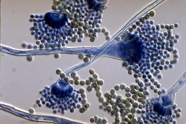 Aspergillus flavus là một trong những loài nấm mốc thường được phân lập nhất trong nông nghiệp và y học. Nó thường được tìm thấy trong đất và có thể lây nhiễm cho nhiều loại cây trồng nông nghiệp quan trọng. Ảnh: enfo.hu.