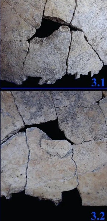 "Kích thước, hình dạng, độ sâu và khoảng cách của các vết thương phù hợp với chấn thương do vết cắn của một loài động vật ăn thịt rất lớn gây ra", tác giả chính của nghiên cứu, Nadezhda Karastoyanova kiêm nhà khảo cổ học động vật tại Bảo tàng Lịch sử Tự nhiên Quốc gia thuộc Viện Hàn lâm Khoa học Bulgaria (NMNH-BAS) cho biết. Ảnh: Karastoyanova et al. (2025), Journal of Archaeological Science: Reports; CC BY-NC-ND 4.0).