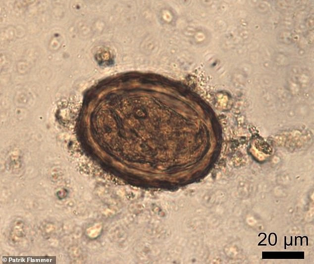 Tác giả nghiên cứu, Tiến sĩ Marissa Ledger cho biết các bệnh nhiễm trùng mãn tính làm suy yếu sức khỏe binh lính La Mã khiến họ không đủ sức để làm nhiệm vụ. Tuy nhiên, tại Bức tường Hadrian, binh lính La Mã có lẽ không còn lựa chọn nào khác ngoài việc tiếp tục làm nhiệm vụ dù tình trạng sức khỏe không tốt. Ảnh: Patrik Flammer.