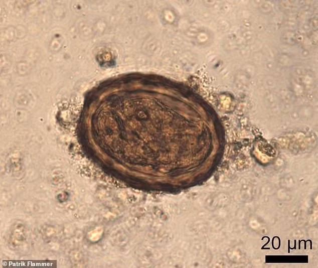 Tác giả nghiên cứu, Tiến sĩ Marissa Ledger cho biết các bệnh nhiễm trùng mãn tính làm suy yếu sức khỏe binh lính La Mã khiến họ không đủ sức để làm nhiệm vụ. Tuy nhiên, tại Bức tường Hadrian, binh lính La Mã có lẽ không còn lựa chọn nào khác ngoài việc tiếp tục làm nhiệm vụ dù tình trạng sức khỏe không tốt. Ảnh: Patrik Flammer.