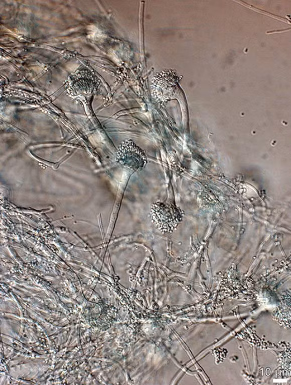Nấm Aspergillus là một giống vi nấm dạng sợi, tồn tại ở nhiều nơi trên thế giới, thường xuyên phát tán hàng triệu bào tử nấm vào không khí. Con người tiếp xúc và hít phải bào tử nấm Aspergillus mỗi ngày nhưng hầu hết mọi người sẽ không gặp bất kỳ vấn đề sức khỏe nào nhờ hệ thống miễn dịch "loại bỏ" chúng. Ảnh: Aspergillus felis (Barrs VR et al).