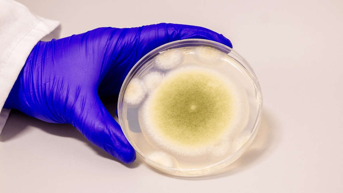 Aspergillus flavus là loại nấm độc chết người liên quan đến các ca tử vong của nhiều chuyên gia khi khai quật lăng mộ cổ. Mới đây, các nhà khoa học tại Đại học Pennsylvania (Mỹ) đã phân lập một nhóm phân tử mới từ Aspergillus flavus và thử nghiệm trên tế bào ung thư máu. Ảnh: Bella Ciervo.