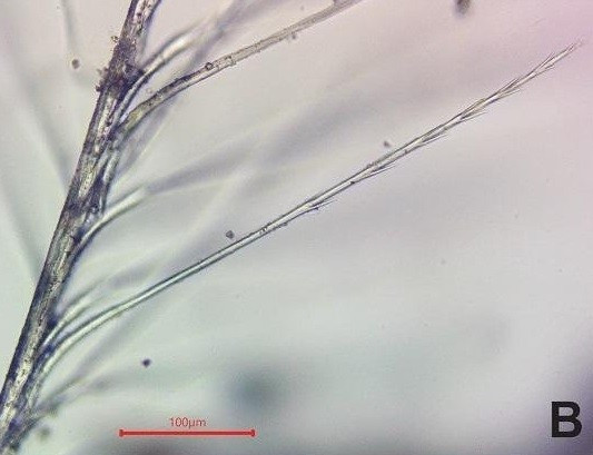 Trong nghiên cứu được công bố ngày 20/2, nhà khảo cổ Kirkinen và các đồng nghiệp đã mô tả chi tiết bằng chứng về các vật liệu dễ phân hủy mà họ tìm thấy trong 35 ngôi mộ tại Skateholm. Đây là địa điểm khảo cổ thời kỳ Hậu Mesolithic ở miền nam Thụy Điển gần bờ biển Baltic, nơi các nhóm săn bắn hái lượm sử dụng làm nghĩa trang từ khoảng năm 5200 trước Công nguyên đến 4800 trước Công nguyên. Ảnh: T. Kirkinen/ Kirkinen et al., Archaeological and Anthropological Sciences (2026).