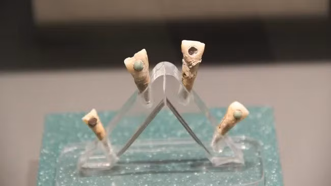 Nhiều thế kỷ trước, trẻ em Maya từ 7 tuổi đã có "ngọc răng" - những miếng ngọc bích khảm trên răng có thể tượng trưng cho sự trưởng thành về mặt xã hội hoặc nghi lễ chuyển giao. Ảnh: Gary Todd, CC0, via Wikimedia Commons.