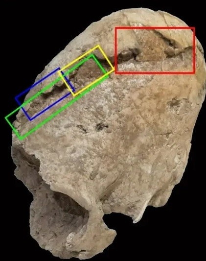 Nhà khảo cổ Alirezazadeh và giáo sư khảo cổ học Hamed Vahdati Nasab tại Đại học Tarbiat Modares đã trình bày chi tiết phân tích của họ về bộ xương thời đại đồ đồng từ nghĩa trang Chega Sofla trong một nghiên cứu được công bố trên Tạp chí Khảo cổ học xương quốc tế. Ảnh: Mahdi Alirezazadeh.