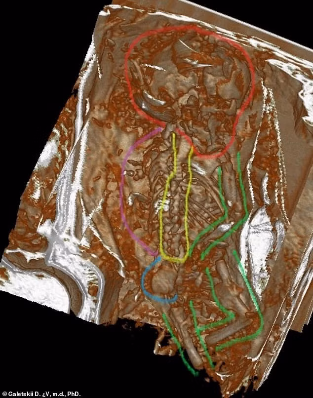Nhóm nghiên cứu tin rằng, Montserrat qua đời cách đây 1.200 năm. Vào thời điểm tử vong, bà mang thai chưa đầy 30 tuần. Ảnh: Galetskii D.V.m.d, PhD.