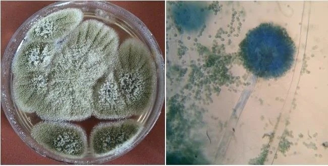 Đến năm 1973, 10 nhà khoa học đã tử vong sau khi tham gia cuộc khai quật lăng mộ của Vua Casimir IV ở Ba Lan. Các cuộc điều tra sau đó phát hiện cả 2 lăng mộ trên đều có loại nấm độc chết người Aspergillus flavus. Ảnh: biologynotesonline.com.