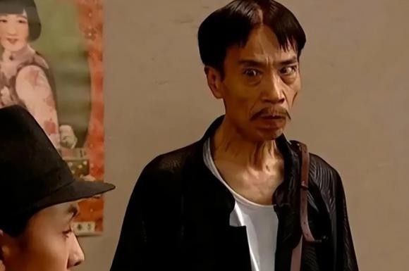 Theo quan niệm của cổ nhân, những người có hai má hóp, gương mặt gầy gò thường bị cho là khó tin cậy, dễ mưu tính thiệt hơn (Ảnh minh họa)