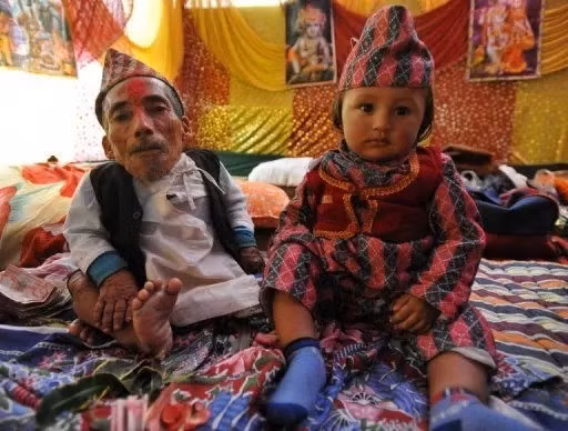 "Những lúc như vậy, tôi tôi thường uống nước nóng và hòa tan một chút bột nghệ", ông Dangi chia sẻ về tình hình sức khỏe. Ảnh: sg.news.yahoo.com.