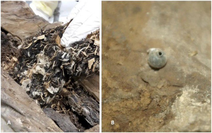 Tuy nhiên, kết quả nghiên cứu do giáo sư y học Andreas Nerlich tại Đại học Ludwig-Maximilians Munich và các đồng nghiệp công bố gần đây cho thấy danh tính của "giáo sĩ phơi khô" là linh mục Franz Xaver Sidler von Rosenegg. Vị quý tộc này làm linh mục quản xứ tại nhà thờ St. Thomas am Blasenstein sống vào giữa thế kỷ 18. Ông qua đời khi khoảng 35 - 45 tuổi. Ảnh: Andreas Nerlich.