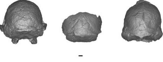 Được phát hiện tại hang động Sterkfontein, Nam Phi vào năm 1998, Little Foot (mã hiệu StW 573) là một trong những bộ xương hóa thạch gần như hoàn chỉnh nhất từng được tìm thấy. Các chuyên gia mất nhiều năm và công sức để hóa thạch tách khỏi lớp đá cứng. Ảnh: Martin et al., Am. J. Biol. Anthropol. 2025.