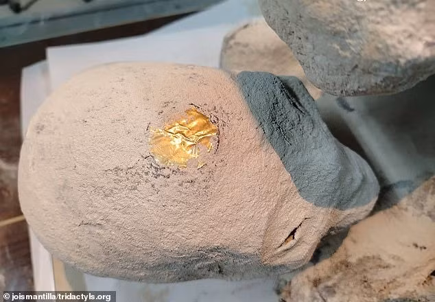 Các chuyên gia xác định tuổi của thai nhi dựa trên kích thước xương đùi, dài 43 mm, được sử dụng để ước tính tuổi thai trong siêu âm trước sinh, cho thấy thai nhi dưới 30 tuần. Ảnh: Jois Mantilla/Tridactyls.org.