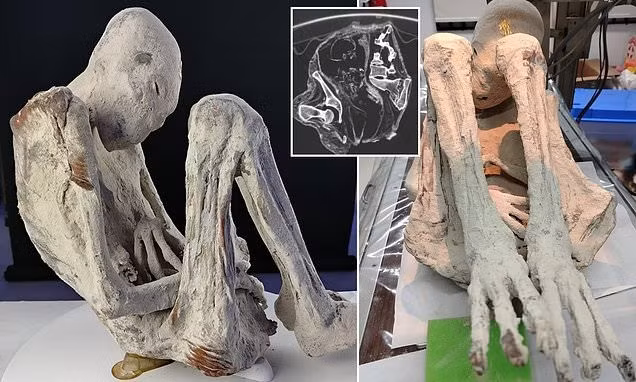 Nhóm nghiên cứu gọi xác ướp Montserrat là "tridactyl" vì bàn tay, bàn chân có ba ngón. Đây là một đặc điểm bất thường đã làm dấy lên suy đoán rằng đó là người ngoài hành tinh hoặc bò sát. Ảnh: Jois Mantilla/Tridactyls.org.