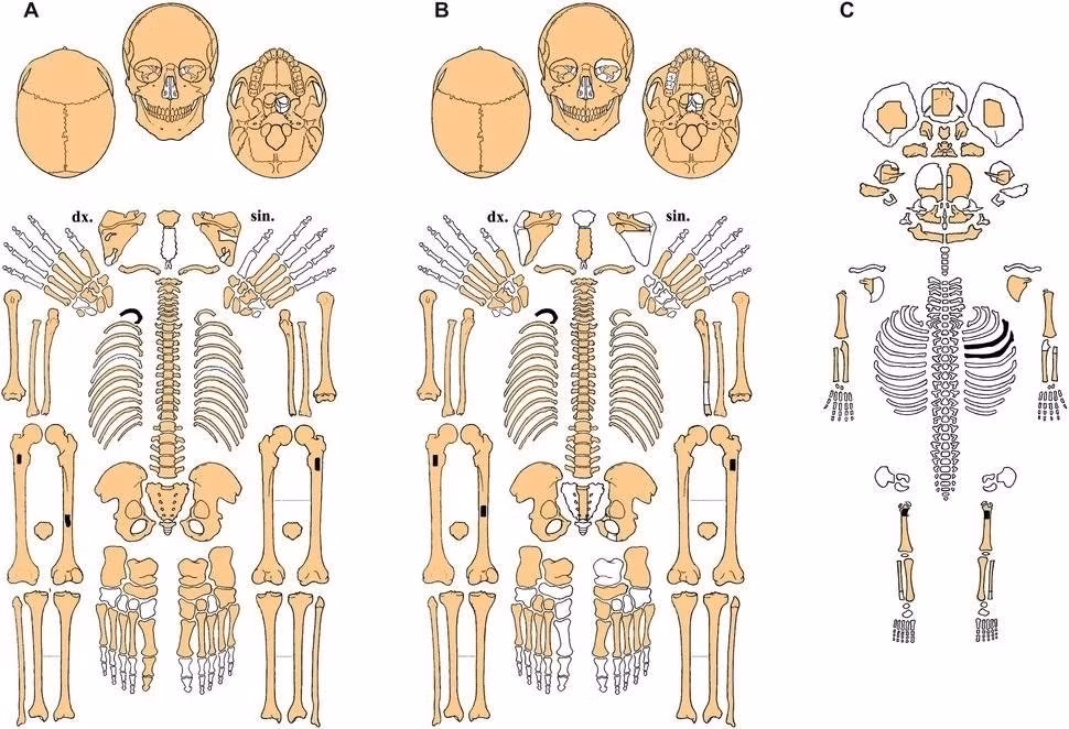 Hình ảnh phục dựng 3D của 2 chị em dựa trên kết quả phân tích hài cốt của họ. Những thi hài này được khai quật tại một mỏ đá lửa thời tiền sử ở vùng Nam Moravia vào hơn 15 năm trước. Ảnh: E. Vaníčková, et al., Archaeolo Anthropol Sci (2025).
