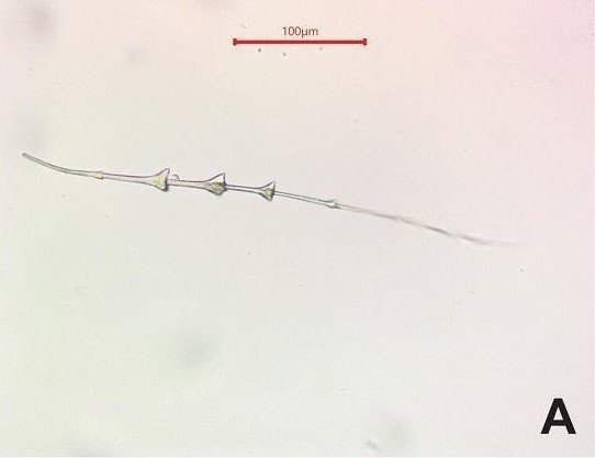 "Nhìn chung, lông thú, sợi thực vật và các vật liệu hữu cơ mềm khác chỉ được tìm thấy trong những điều kiện đặc biệt, chẳng hạn như ở các địa điểm dưới nước hoặc trong các sông băng. Với phương pháp mới, chúng tôi có thể tìm thấy các sợi siêu nhỏ ngay cả ở những khu vực có điều kiện bảo quản kém", nhà khảo cổ Tuija Kirkinen tại Đại học Helsinki cho biết. Ảnh: T. Kirkinen/ Kirkinen et al., Archaeological and Anthropological Sciences (2026).