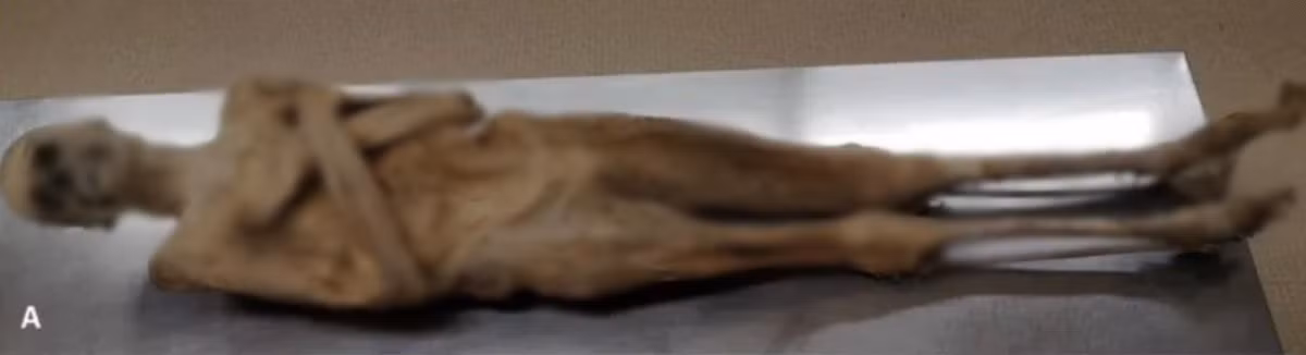 Một bí ẩn lớn được giới nghiên cứu giải mã trong năm 2025 là xác định danh tính của một thi hài được bảo quản rất tốt. Bộ hài cốt này được tìm thấy trong một nhà thờ hẻo lánh của Áo từ những năm 1700. Ảnh: Andreas Nerlich.