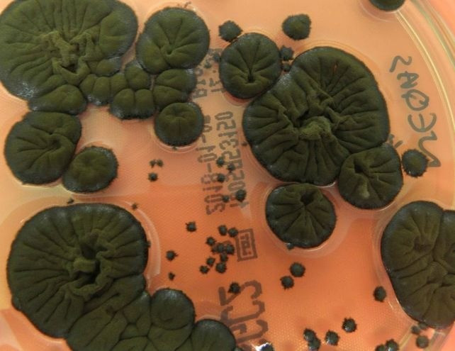 Vào cuối những năm 1990, các nhà khoa học kiểm tra khu vực bên trong lò phản ứng Chernobyl và có phát hiện bất ngờ. Cuộc khảo sát ghi nhận 37 loại nấm mốc đen phủ kín trần nhà, tường và cả các bề mặt kim loại. Ảnh: Rui Tomé/Atlas of Mycology.