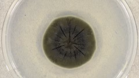 Đó chính là nấm Cladosporium sphaerospermum. Loại nấm này có màu đen là do tế bào chứa đầy melanin. Ảnh: Medmyco / Wikimedia Commons.