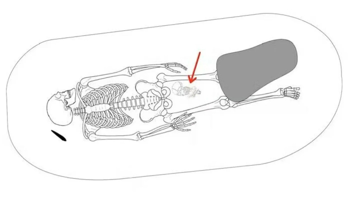 Người phụ nữ mang thai mặc chiếc áo choàng cài khuy ở cổ và một phụ kiện đính hạt giống như ngọc trai. Ảnh: Matt Hitchcock / Body-Politics CC BY-SA 4.0.